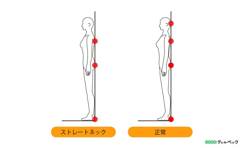 ストレートネックのセルフチェック