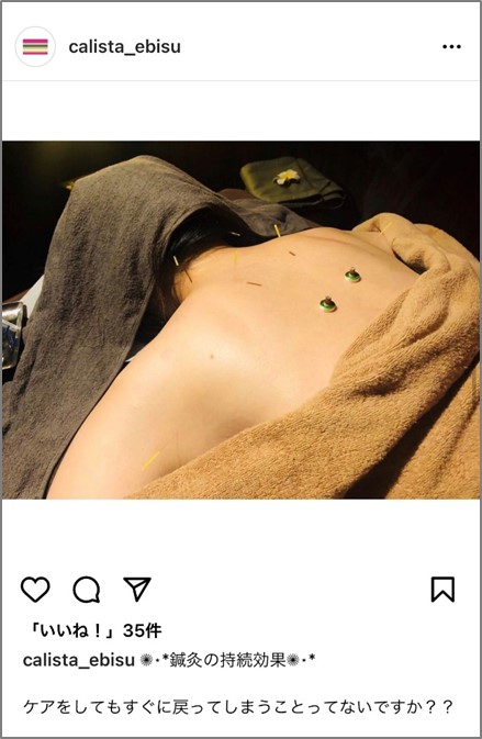 鍼と艾(もぐさ)の灸